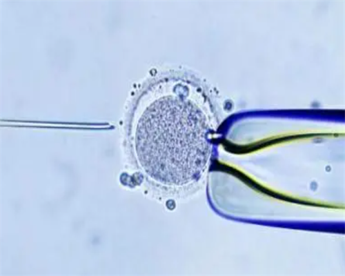 广州助孕机构排名哪家好？广州三大助孕机构邀您接好孕_正规供卵的