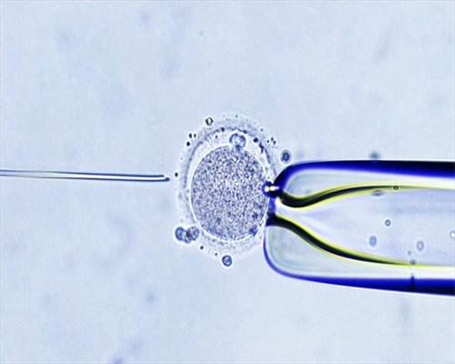 郑州试管捐卵生子有偿捐卵平台婴儿花费明细表