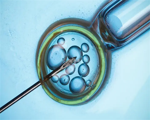 3个月上海助孕宝宝奶量