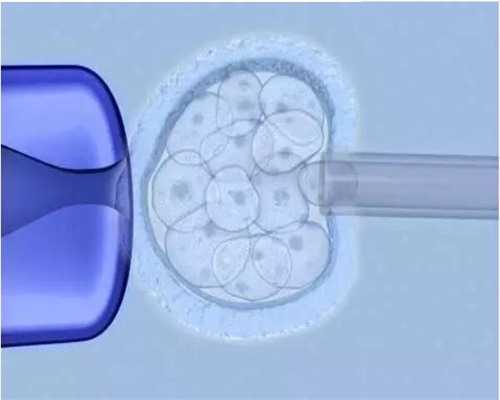 石家庄试管供卵助孕费用,石家庄三代试管公司,石家庄市四院试管婴儿三代