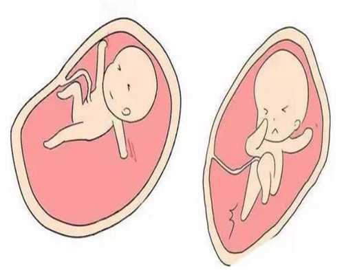 2026年想要快速，掌握这4个备孕小技巧助你早日怀上虎上海助孕宝宝