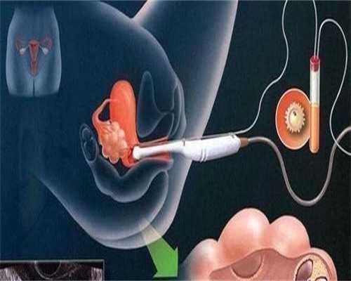 石家庄试管能三代试管的方式有哪些(石家庄试管婴儿成功率)