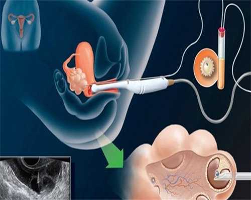 广州试管供卵生子助孕机构排名，附广东助孕机构一览！_iphone5s超薄保护壳