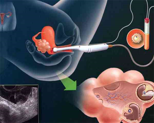 石家庄代怀试管中心,石家庄助孕网-石家庄辅助生殖中心