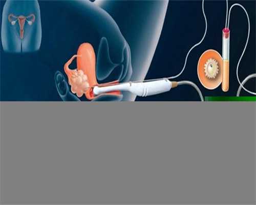 找一个重庆助孕网 重庆私立助孕机构收费明细参考指南 ‘彩超看男女’