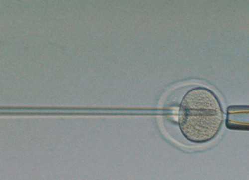 2026郑州供卵的私立机构最新发布，附供卵三代生男孩费用详情