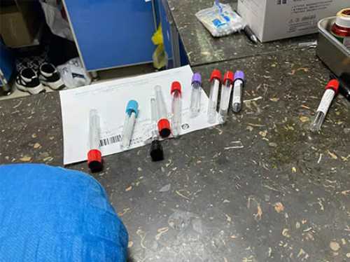 上海助孕宝宝奶量少怎么办上海助孕宝宝奶量少体重增长缓慢